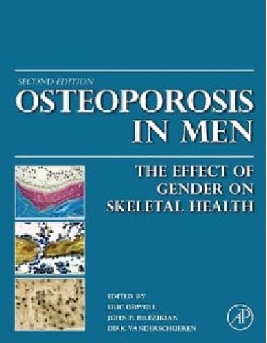 Osteoporosis in Men: The Effects of Gender on Skeletal Health
