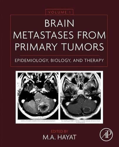 Brain Metastases from Primary Tumors: Epidemiology, Biology, and Therapy