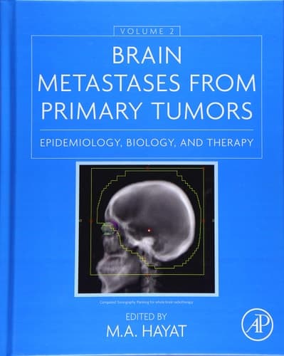 Brain Metastases from Primary Tumors, Volume 2: Epidemiology, Biology, and Therapy