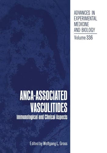 ANCA-Associated Vasculitides Immunological and Clinical Aspects
