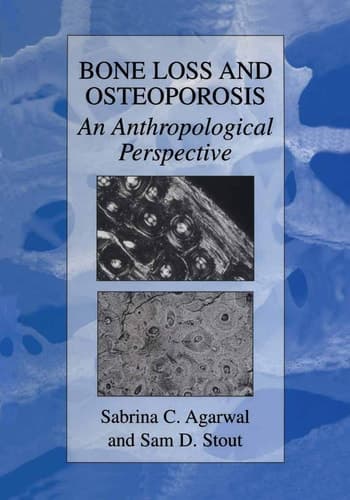 Bone Loss and Osteoporosis An Anthropological Perspective