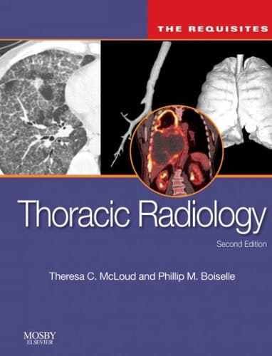 Thoracic Radiology The Requisites