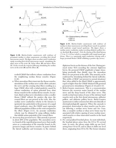 Electromyography in Clinical Practice A Case Study Approach