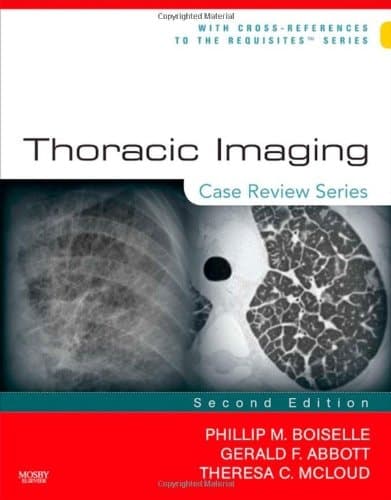 Thoracic Imaging Case Review