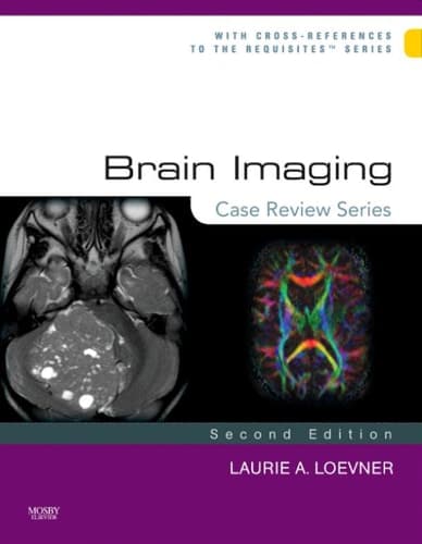 Brain Imaging Case Review