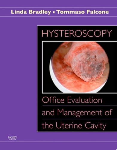 Hysteroscopy Office Evaluation and Management of the Uterine Cavity