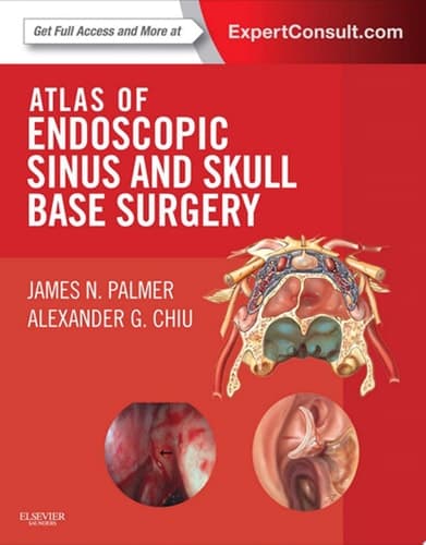 Atlas of Endoscopic Sinus and Skull Base Surgery Expert Consult - Online and Print