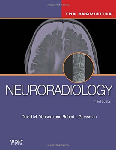Neuroradiology The Requisites