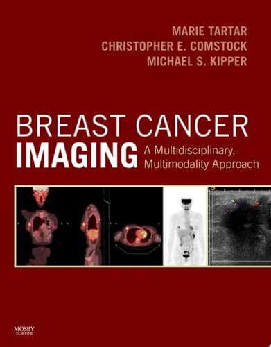 Breast Cancer Imaging A Multidisciplinary, Multimodality Approach