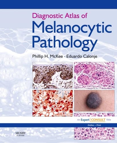 Diagnostic Atlas of Melanocytic Pathology Expert Consult: Online and Print