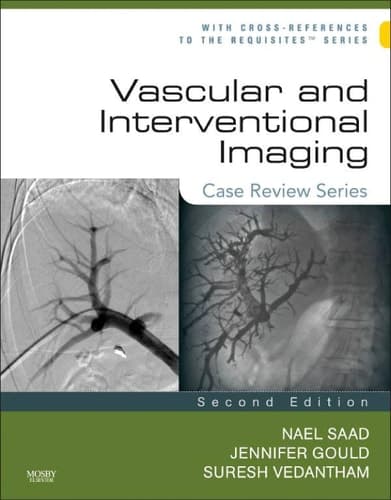 Vascular and Interventional Imaging Case Review