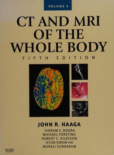 CT and MRI of the Whole Body
