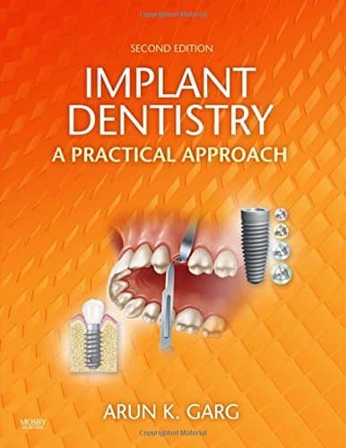 Implant Dentistry A Practical Approach