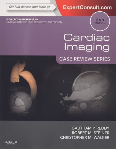 Cardiac Imaging Case Review