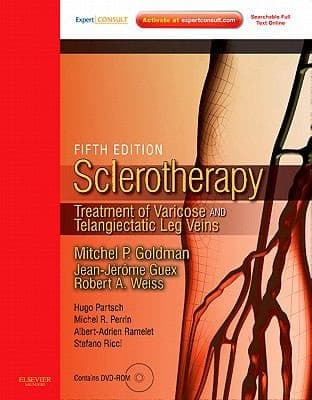Sclerotherapy Treatment of Varicose and Telangiectatic Leg Veins