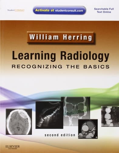 Learning Radiology Recognizing the Basics