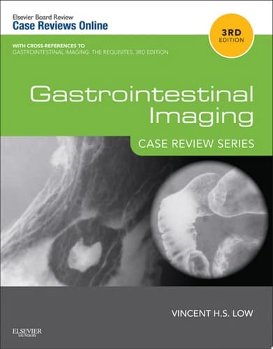 Gastrointestinal Imaging: Case Review Series