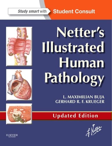 Netter's Illustrated Human Pathology