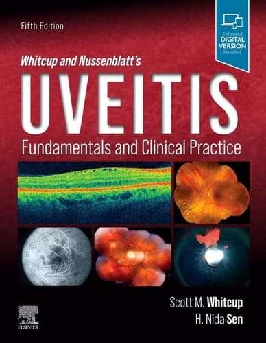 Whitcup and Nussenblatt's Uveitis Fundamentals and Clinical Practice