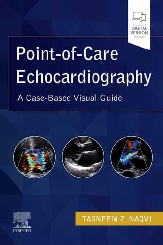 Point-Of-Care Echocardiography A Clinical Case-Based Visual Guide