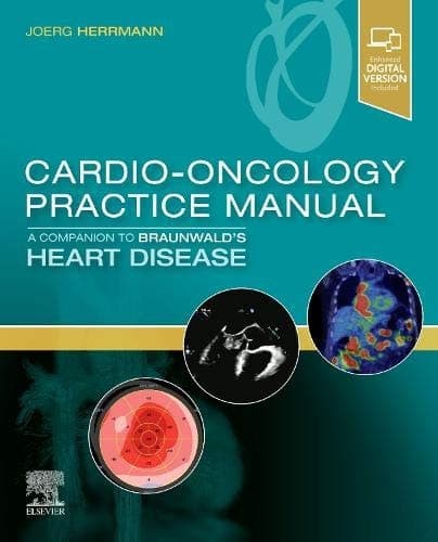 Cardio-Oncology Practice Manual: a Companion to Braunwald's Heart Disease