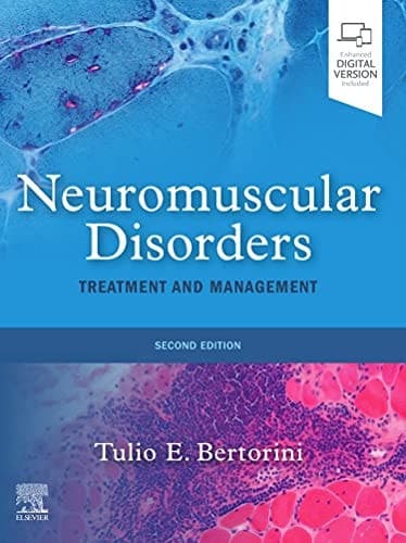 Neuromuscular Disorders Treatment and Management