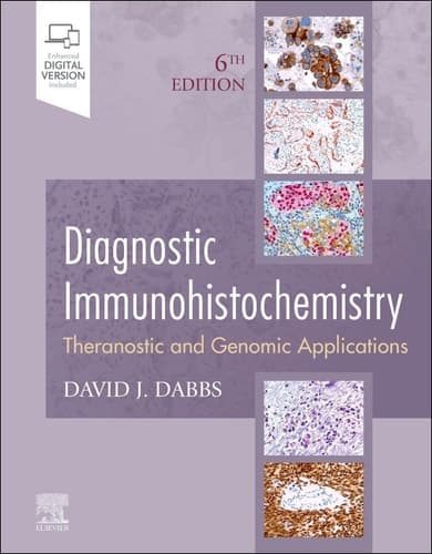 Diagnostic Immunohistochemistry Theranostic and Genomic Applications