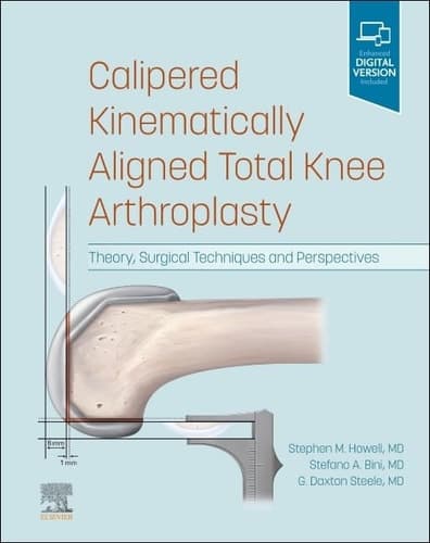 KINEMATIC KNEE ALIGNMENT Theory, Surgical Techniques and Perspectives