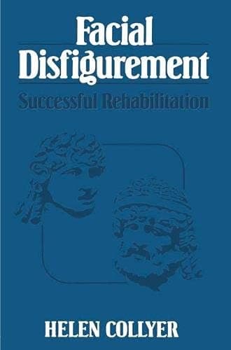 Facial Disfigurement: Successful Rehabilitation