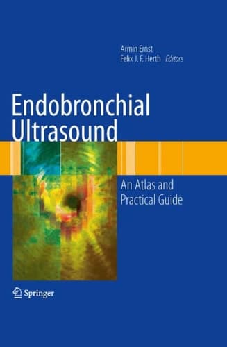 Endobronchial Ultrasound An Atlas and Practical Guide