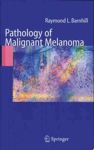 Pathology of Malignant Melanoma