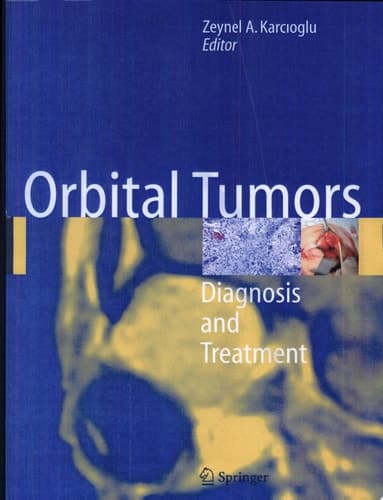 Orbital Tumors Diagnosis And Treatment