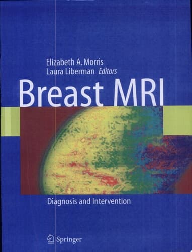Breast MRI Diagnosis and Intervention