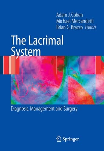 The Lacrimal System Diagnosis, Management and Surgery