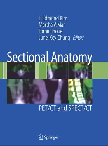Sectional Anatomy PET/CT and SPECT/CT