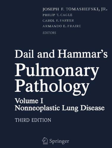 Dail and Hammar's Pulmonary Pathology Volume II: Neoplastic Lung Disease