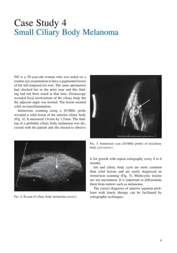 Clinical Ophthalmic Echography A Case Study Approach