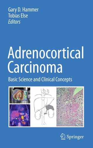 Adrenocortical Carcinoma Basic Science and Clinical Concepts