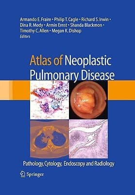 Atlas of Neoplastic Pulmonary Disease Pathology, Cytology, Endoscopy and Radiology