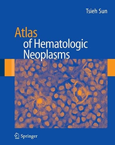 Atlas of Hematologic Neoplasms