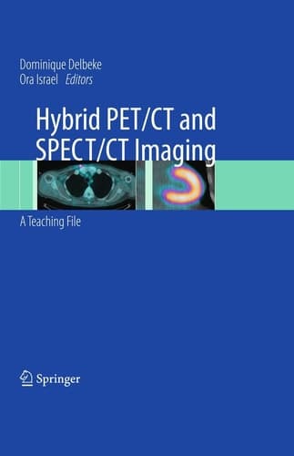 Hybrid PET/CT and SPECT/CT Imaging A Teaching File