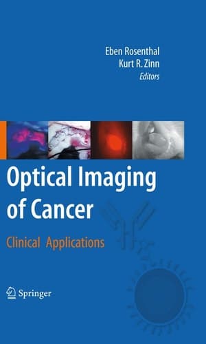 Optical Imaging of Cancer Clinical Applications