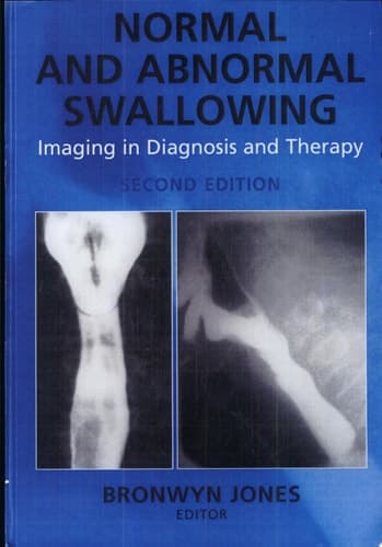 Normal and Abnormal Swallowing Imaging in Diagnosis and Therapy