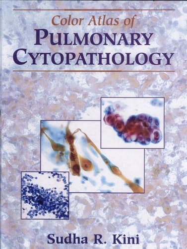 Color Atlas of Pulmonary Cytopathology