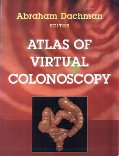 Atlas of Virtual Colonoscopy