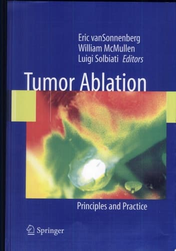 Tumor Ablation Principles and Practice