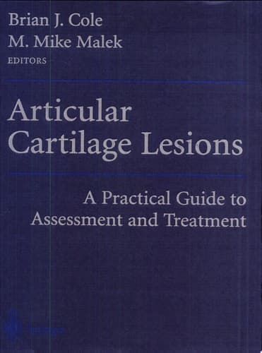 Articular Cartilage Lesions A Practical Guide to Assessment and Treatment