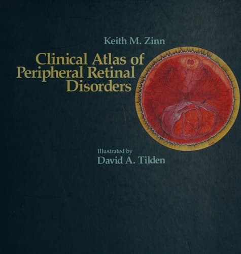Clinical Atlas of Peripheral Retinal Disorders