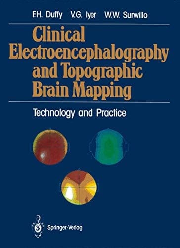 Clinical Electroencephalography and Topographic Brain Mapping: Technology and Practice