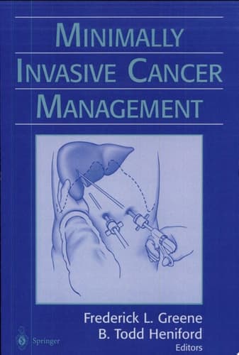 Minimally Invasive Cancer Management